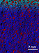 NIST engineers are patenting a method that is expected to double the service life of concrete. The key is a nano-sized additive