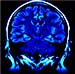 Light switches, TV remote controls and even house keys could become a thing of the past thanks to brain-computer interface (BCI) technology being developed in Europe that lets users perform everyday tasks with thoughts alone