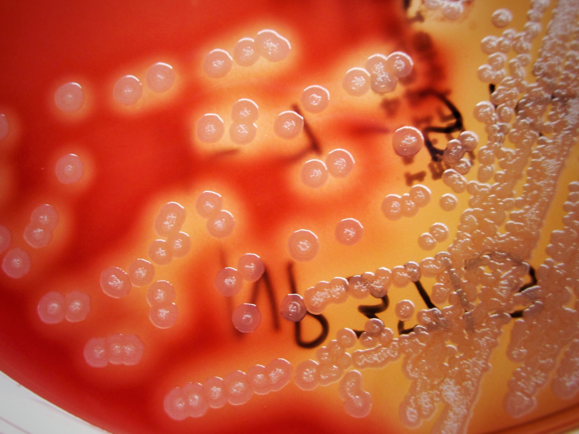 The Surprising Combo That Makes Concrete Stronger: Jute and Bacteria