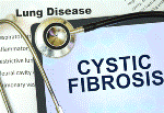 New Virtual Strategic Research Centre Created to Tackle Cystic Fibrosis