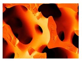 Scientists Take Cue from Sea Urchin Spines to Optimize Cement